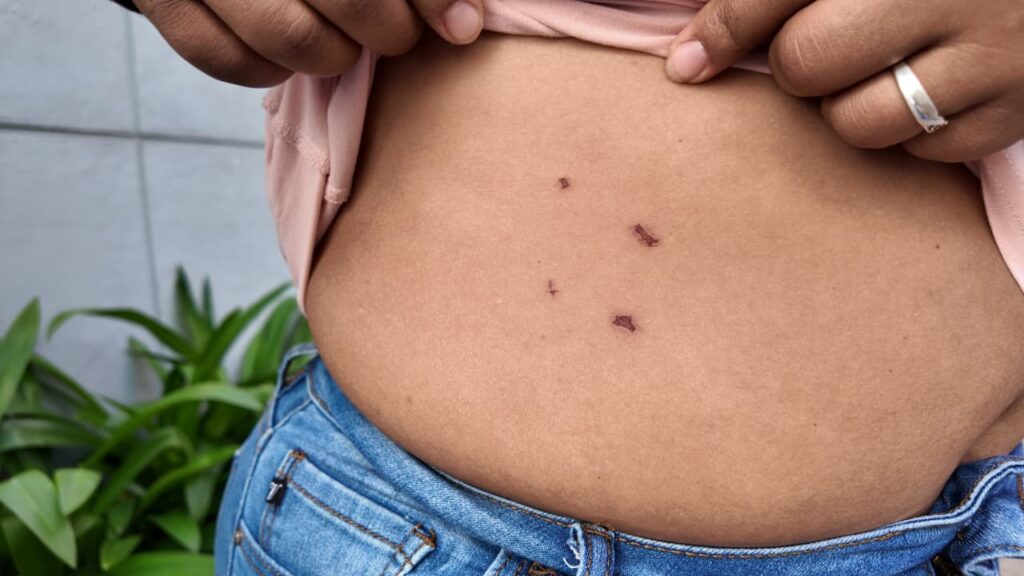 Denuncian presunto abuso policial y agresión contra familia en el sector El Almirante - Noticias de hoy en República Dominicana | De Último Minuto