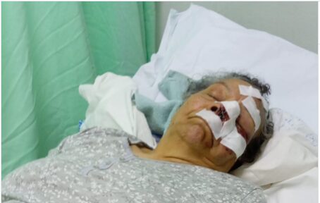 Joven y su abuela resultan heridos tras lanzamiento de peñón en puente de SDE - Noticias de hoy en República Dominicana | De Último Minuto