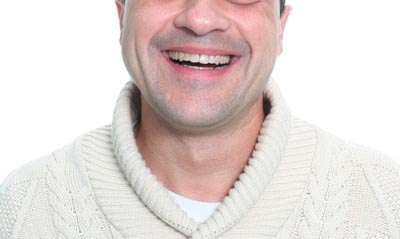 Tratamiento correctivo en adultos. Caso clínico: después.