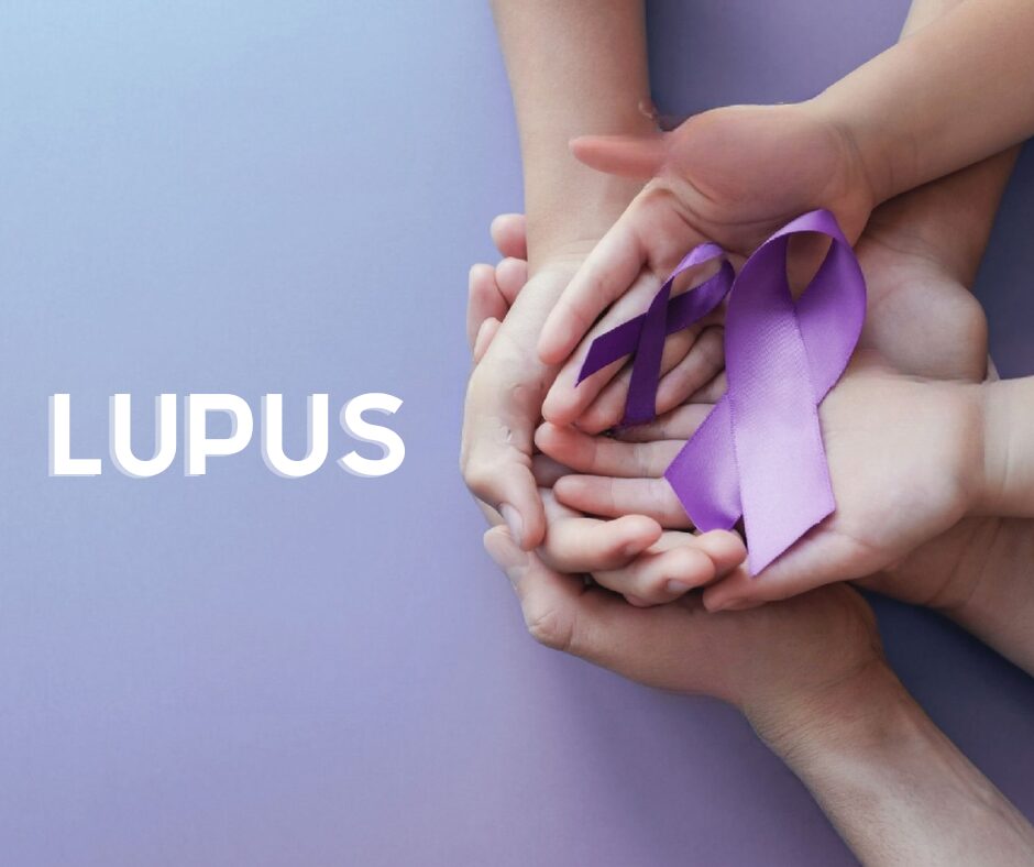Día Mundial del Lupus: Visibilizando una enfermedad silenciosa y complicada | 2 | Día Mundial del Lupus: Visibilizando una enfermedad silenciosa y complicada - Noticias de hoy en República Dominicana | De Último Minuto