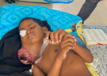 Familia clama por ayuda para salvar la vida de su hijo con tumor en Santiago