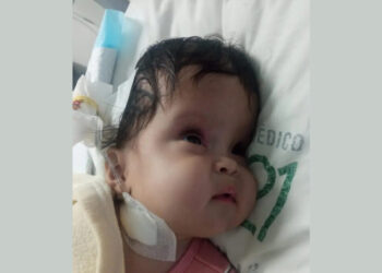 Piden ayuda para operar de la cabeza a una bebé de tres meses