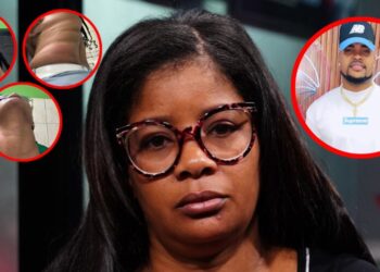 Mujer fue agredida por su expareja en San Pedro y denuncia teme por su vida ante negligencia de Fiscalía