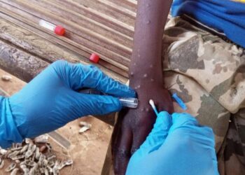 La OMS mantiene la emergencia internacional por la mpox ante el elevado número de casos