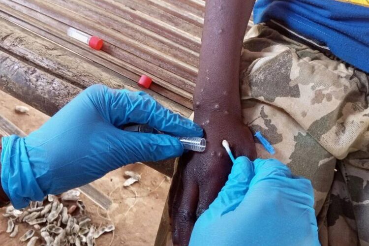 La OMS mantiene la emergencia internacional por la mpox ante el elevado número de casos