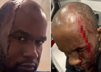 Acuchillan en la cabeza a ejecutivo de TikTok en el metro de Nueva York