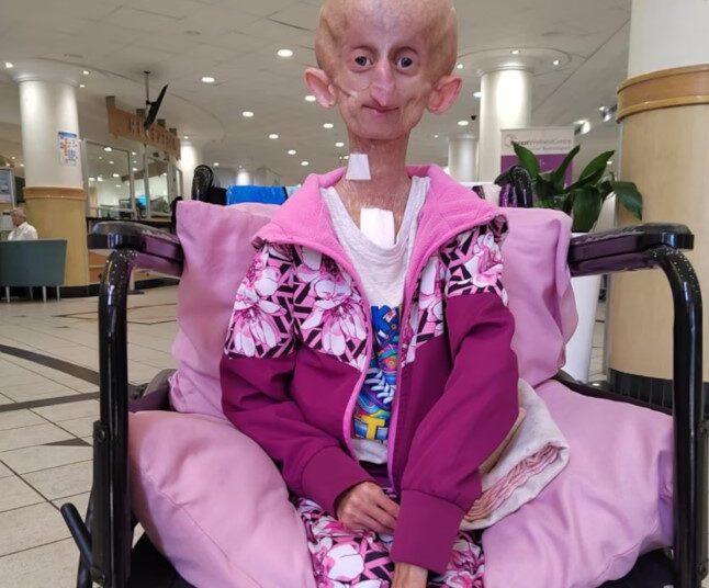 Muere la tiktoker de 19 años que luchaba contra una rara enfermedad genética