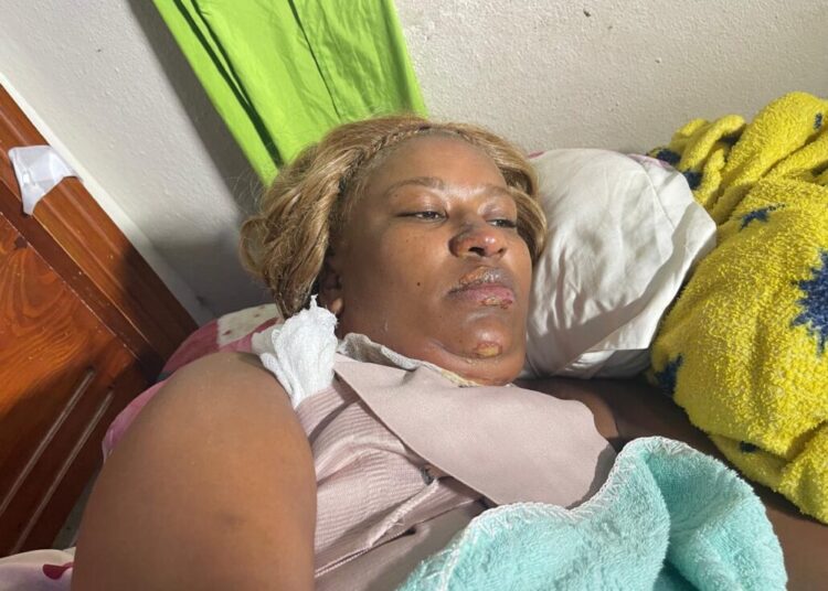 Hombre prende fuego a ex pareja porque se negaba a reconciliación en Santiago