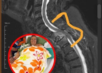 Familiares de mujer con cáncer de células plasmáticas solicitan ayuda para costear costosos tratamiento