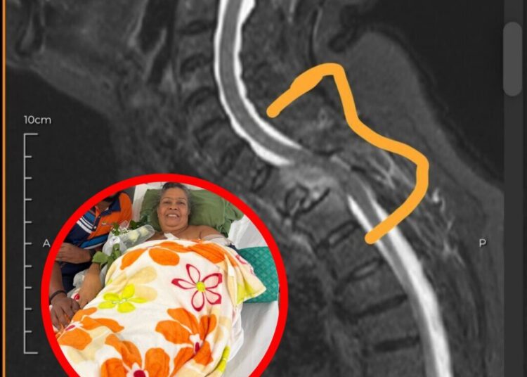 Familiares de mujer con cáncer de células plasmáticas solicitan ayuda para costear costosos tratamiento