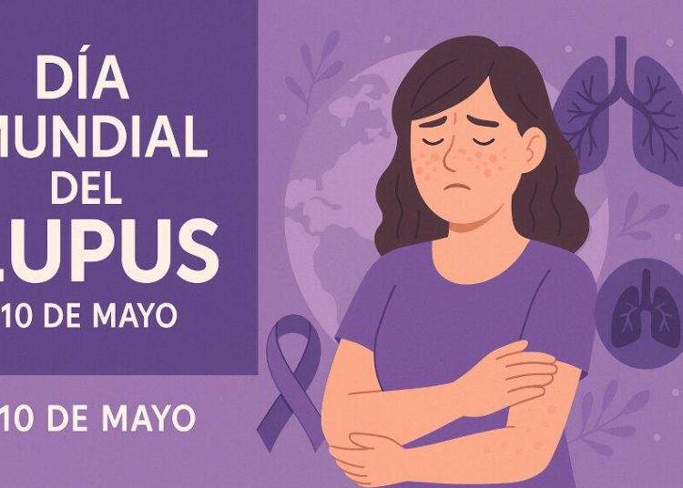 Día Mundial del Lupus: Visibilizando una enfermedad silenciosa y complicada