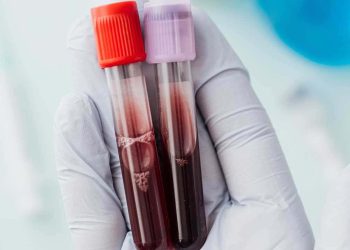 El 28 de mayo es Día Mundial del Cáncer de Sangre: una lucha por la vida y la esperanza