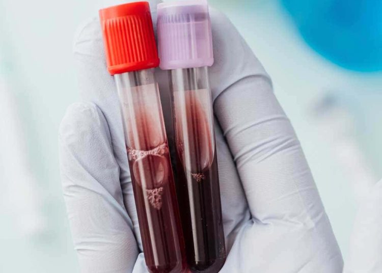 El 28 de mayo es Día Mundial del Cáncer de Sangre: una lucha por la vida y la esperanza