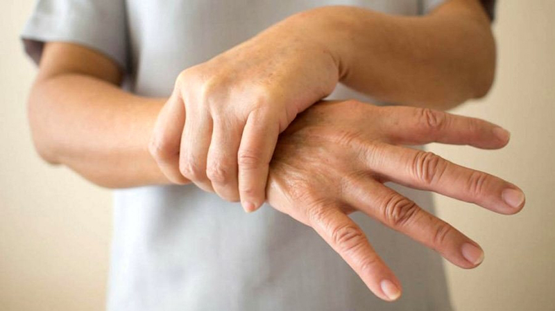 29 de junio: Día Mundial de la Esclerodermia, una enfermedad rara que endurece la piel | 2 | 29 de junio: Día Mundial de la Esclerodermia, una enfermedad rara que endurece la piel - Noticias de hoy en República Dominicana | De Último Minuto