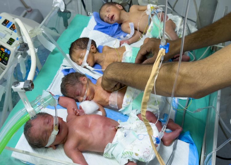 Muere otro menor por desnutrición severa en Gaza