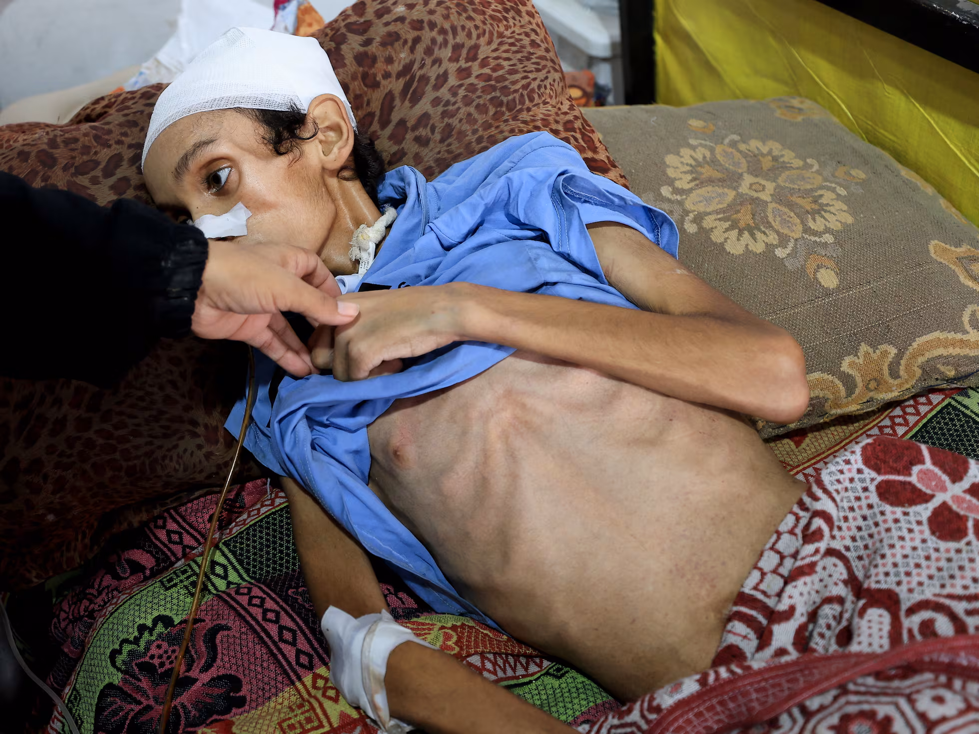 Han muerto más gazatíes por desnutrición en lo que va de 2025 que en los dos años previos