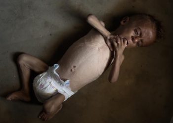 La desnutrición mata a cinco personas, incluido un bebé, en las últimas 24 horas en Gaza