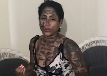 «La Barbie Mundo» permanece ingresada en el Hospital Vinicio Calventi; autoridades llaman a sus familiares