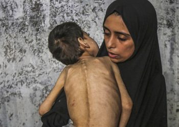 Trump sobre Gaza: «Según la TV, los niños parecen tener mucha hambre»