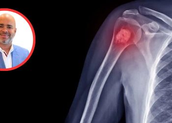 Aumentan tumores a nivel óseo en pacientes luego del Covid-19, afirman especialistas