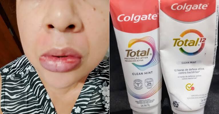 DIGEMAPS alerta sobre pasta dental Colgate Total Clean Mint con presencia de Fluoruro de Estaño | 2 | DIGEMAPS alerta sobre pasta dental Colgate Total Clean Mint con presencia de Fluoruro de Estaño - Noticias de hoy en República Dominicana | De Último Minuto