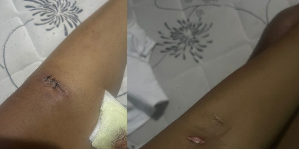 Joven agredida sexualmente por vecino en Villa Mella pide a PN agilizar su captura - Noticias de hoy en República Dominicana | De Último Minuto