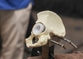 Farmaconal realizó la Jornada de Artroplastia, un encuentro científico de alto nivel sobre el reemplazo articular de cadera