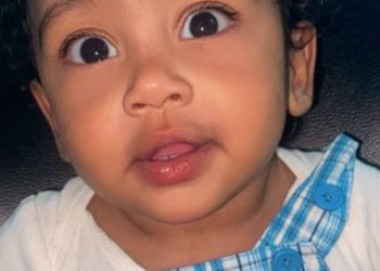 La lucha de Danzel: un bebé que necesita ayuda para una cirugía cardíaca urgente