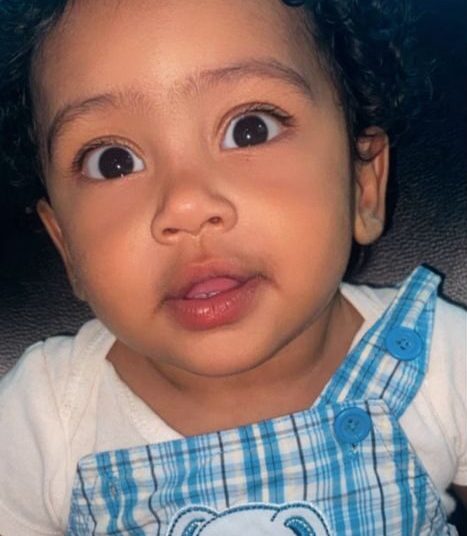 La lucha de Danzel: un bebé que necesita ayuda para una cirugía cardíaca urgente