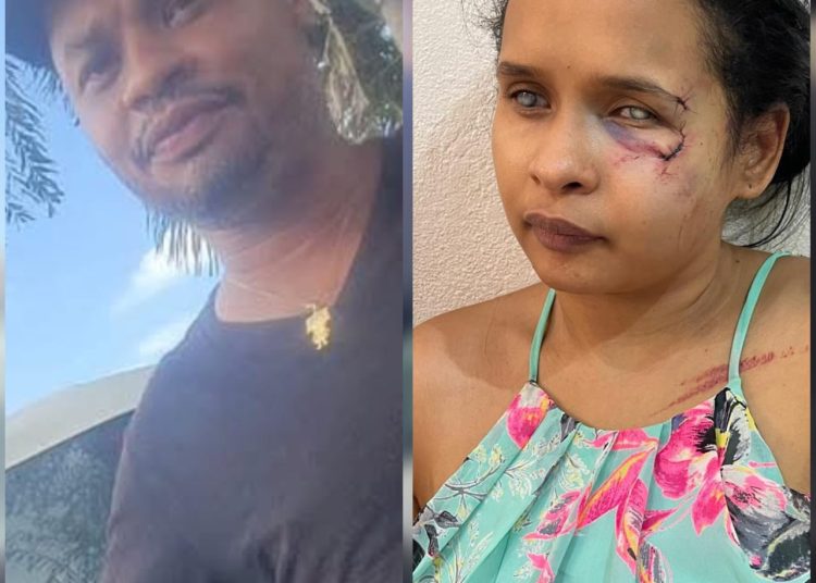 Mujer denuncia agresión por parte de su expareja en Monseñor Nouel