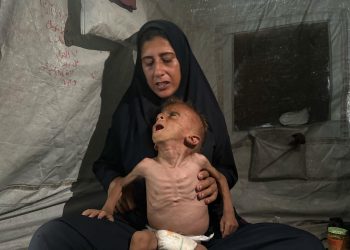 Enfermos y desnutridos, los niños de Gaza que Israel llama ‘fake news’ también pasan hambre