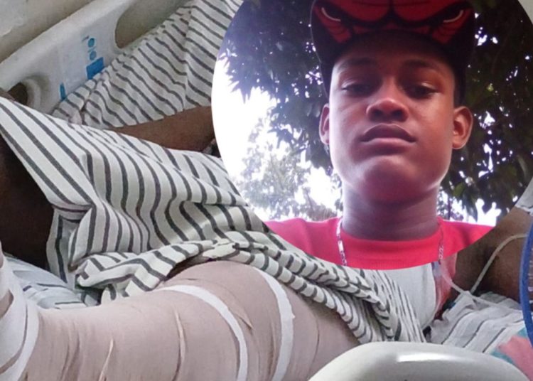 Solicitan ayuda económica para operación de joven accidentado en Santo Domingo
