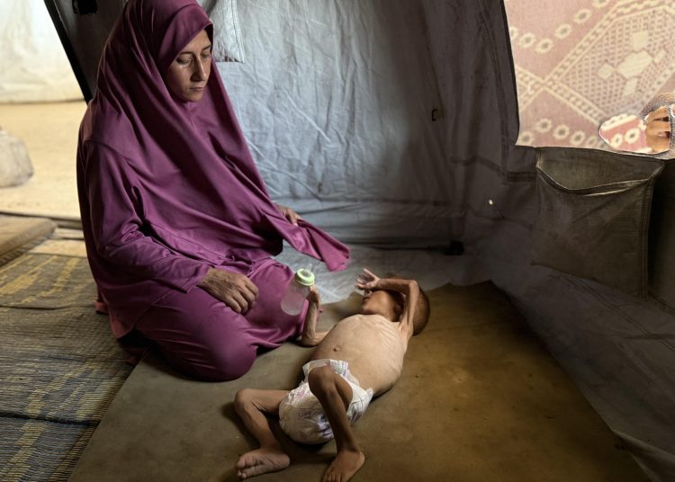 Mueren diez personas por desnutrición en Gaza, entre ellos dos bebés