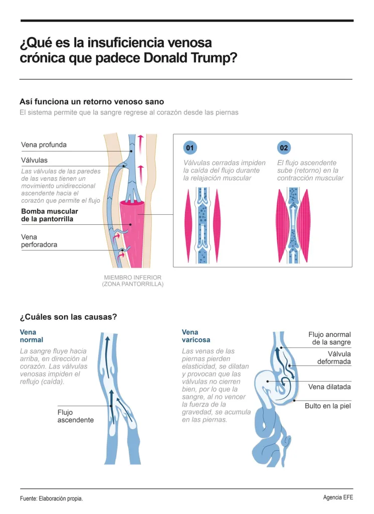 ¡Es falso! Trump no ha sido diagnosticado con una enfermedad mortal - Noticias de hoy en República Dominicana | De Último Minuto
