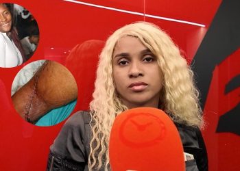 Mujer lesionada denuncia que agresora fue dejada en libertad en San Cristóbal