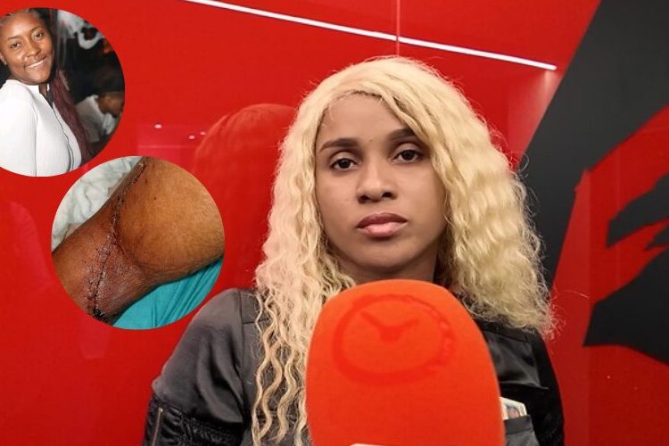 Mujer lesionada denuncia que agresora fue dejada en libertad en San Cristóbal