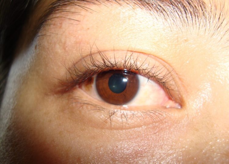 Las enfermedades de la retina: un llamado a la prevención para proteger la visión