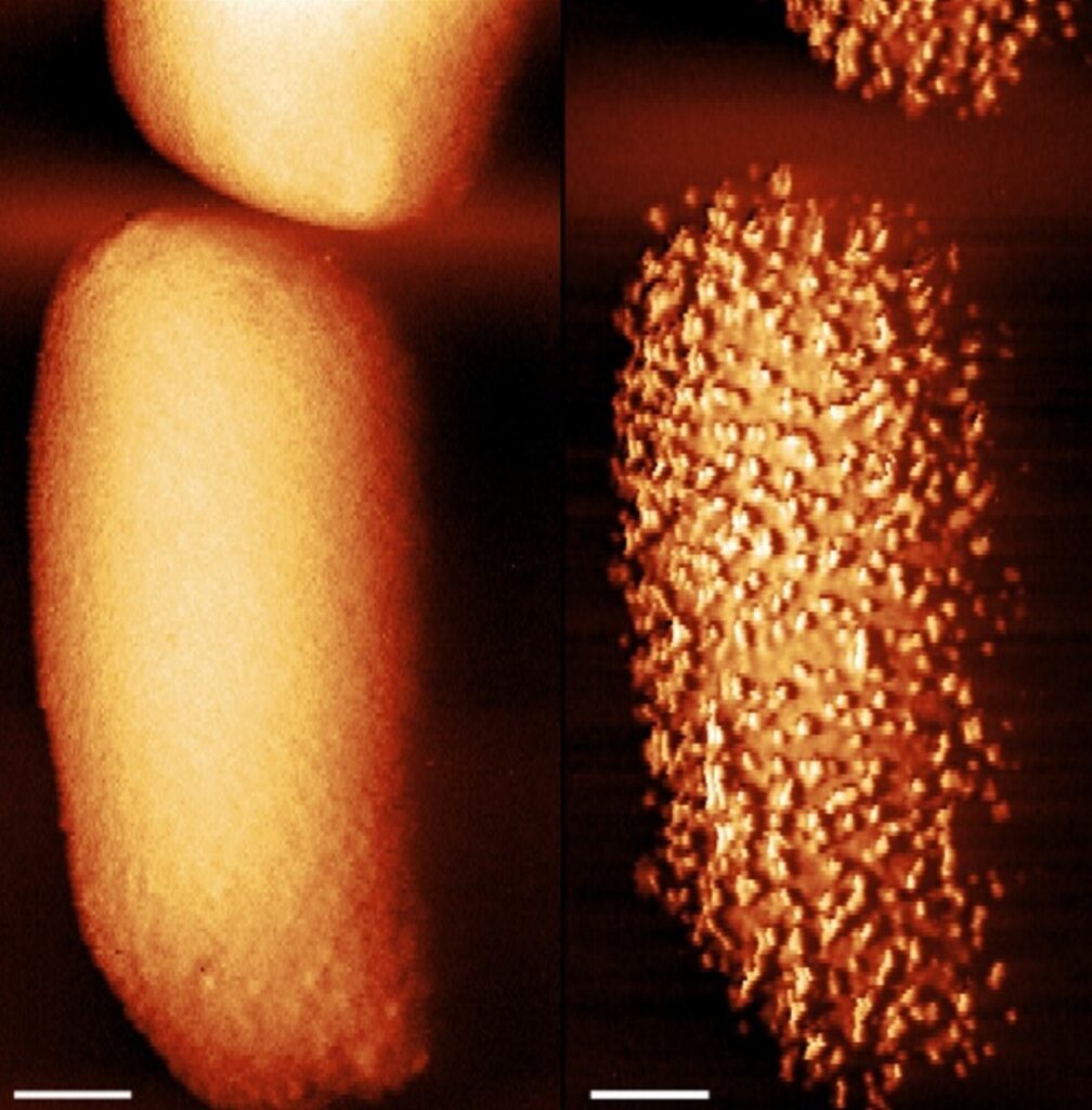 Captan las primeras imágenes de un antibiótico aniquilando bacterias en tiempo real - Noticias de hoy en República Dominicana | De Último Minuto