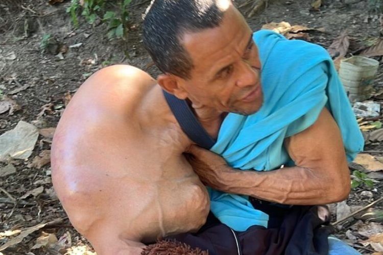 Hombre diagnosticado con tumor solicita ayuda médica en El Factor, Nagua