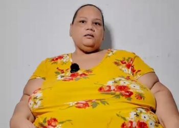 Mujer de 46 años solicita ayuda para cirugía bariátrica tras complicaciones de salud