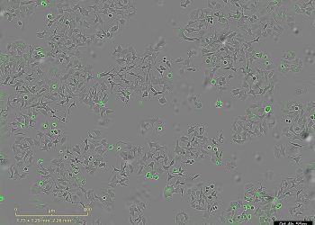 Descubren un mecanismo bacteriano que podría destruir células tumorales