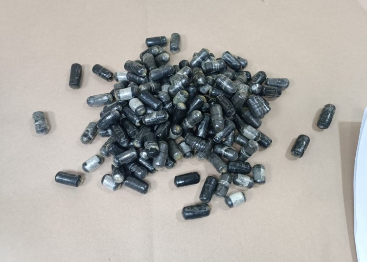 Atrapan en el AILA francés con estómago lleno de bolsitas de cocaína