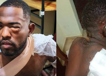 “El policía me dio en la cara y me electrocutó varias veces”, relata joven tras presunto abuso policial