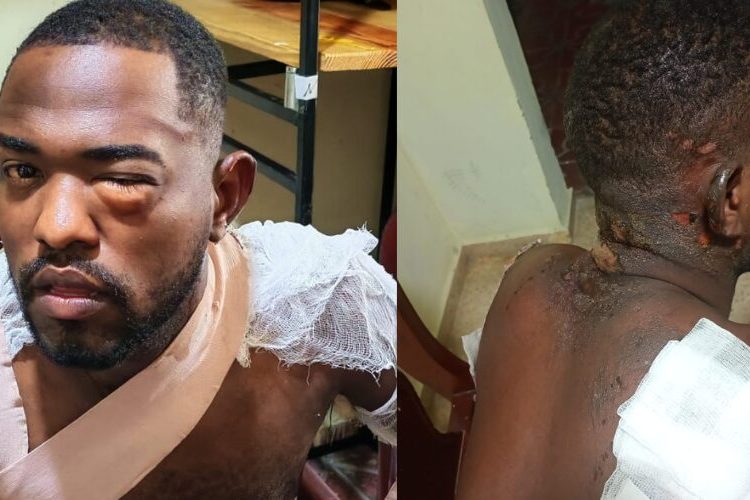 “El policía me dio en la cara y me electrocutó varias veces”, relata joven tras presunto abuso policial