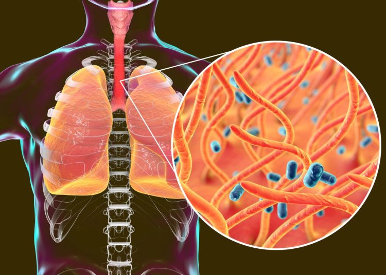 Panamá alerta a Costa Rica por brote de tos ferina en área indígena cercana a la frontera