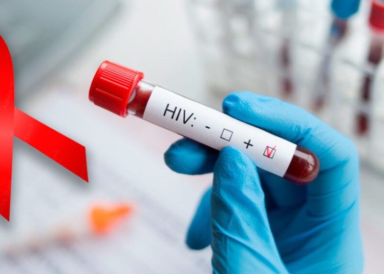 RD destaca por avances en VIH y control de enfermedades