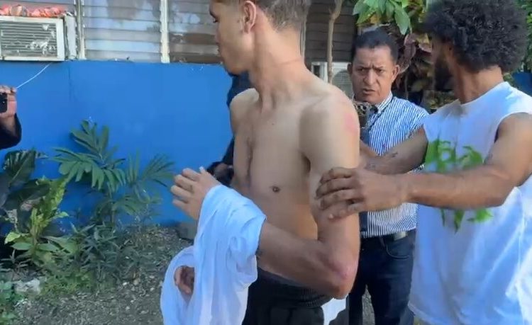 Dos jóvenes denuncian abuso policial en San Francisco de Macorís