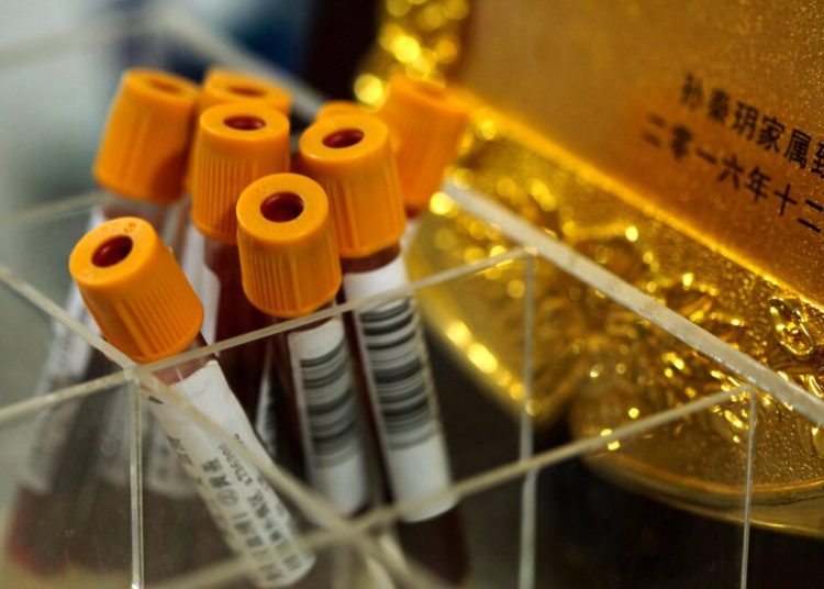 China desmantela dos redes que traficaban con muestras de sangre de mujeres embarazadas