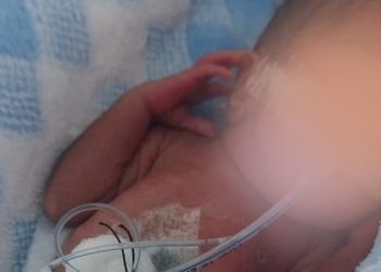 Familiares solicitan apoyo para cubrir gastos médicos de bebé prematuro extremo en Samaná