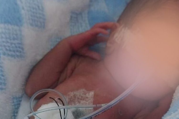 Familiares solicitan apoyo para cubrir gastos médicos de bebé prematuro extremo en Samaná